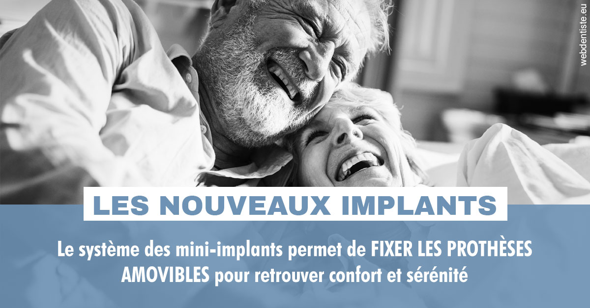 https://www.centre-dentaire-asnieres-les-gresillons.fr/Les nouveaux implants 2