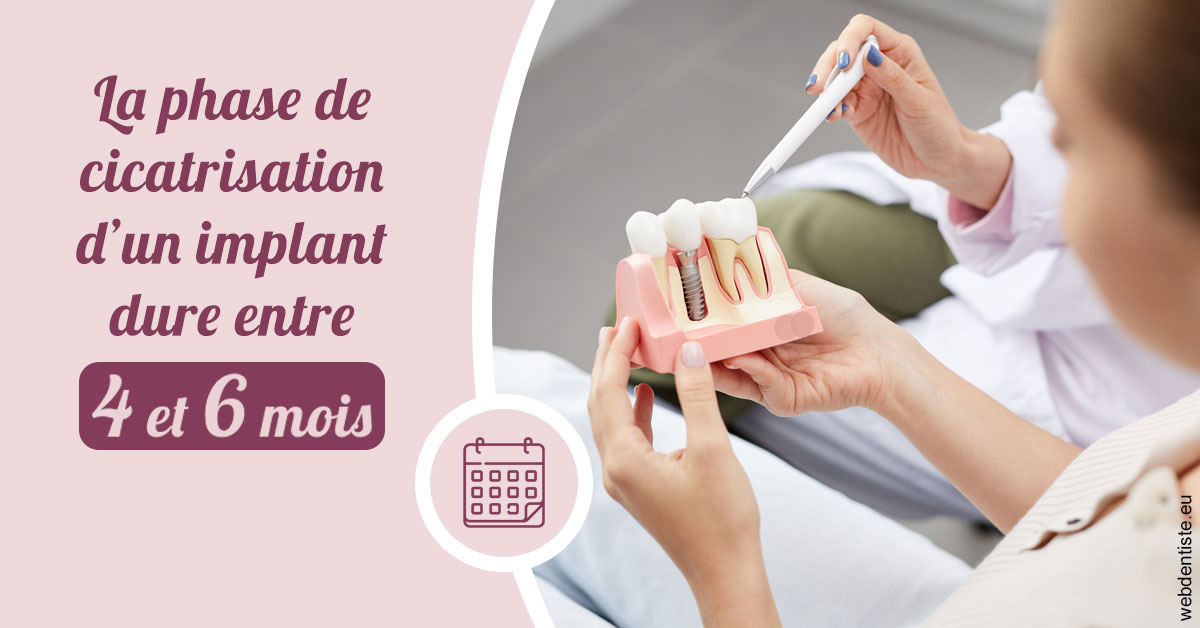 https://www.centre-dentaire-asnieres-les-gresillons.fr/Cicatrisation implant 2