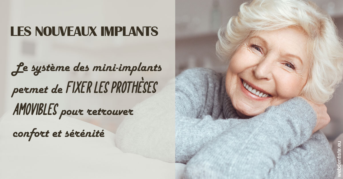 https://www.centre-dentaire-asnieres-les-gresillons.fr/Les nouveaux implants 1