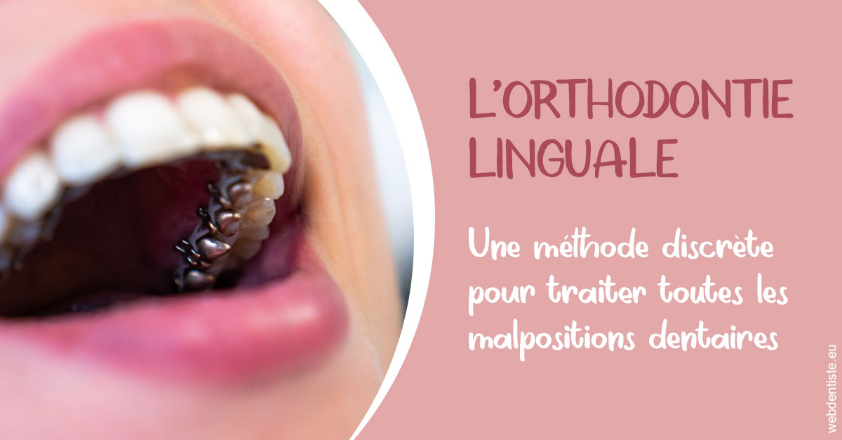https://www.centre-dentaire-asnieres-les-gresillons.fr/L'orthodontie linguale 2
