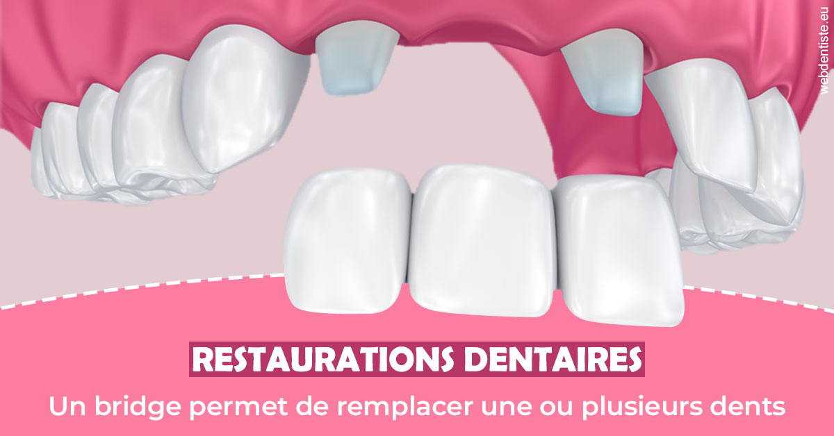 https://www.centre-dentaire-asnieres-les-gresillons.fr/Bridge remplacer dents 2