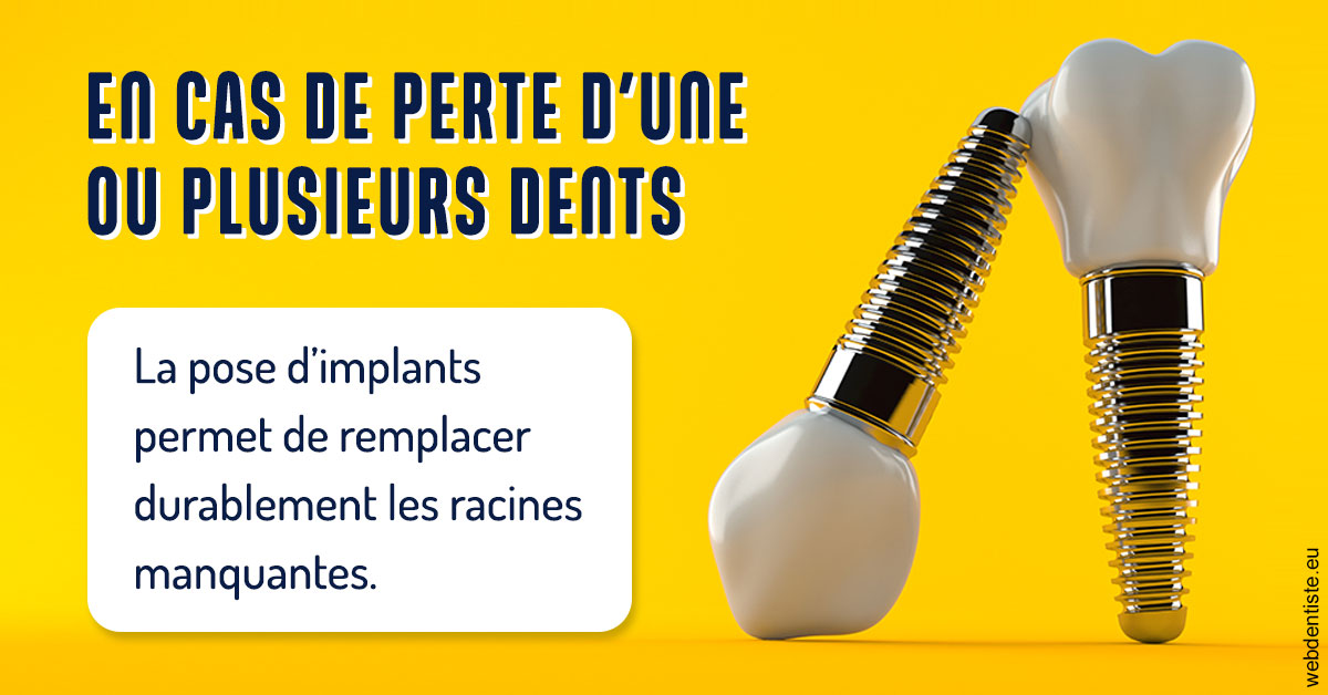 https://www.centre-dentaire-asnieres-les-gresillons.fr/2024 T1 - Implants 02