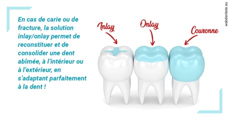 https://www.centre-dentaire-asnieres-les-gresillons.fr/L'INLAY ou l'ONLAY