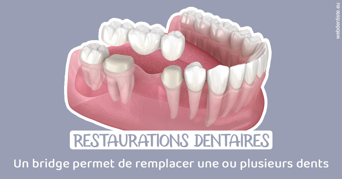https://www.centre-dentaire-asnieres-les-gresillons.fr/Bridge remplacer dents 1