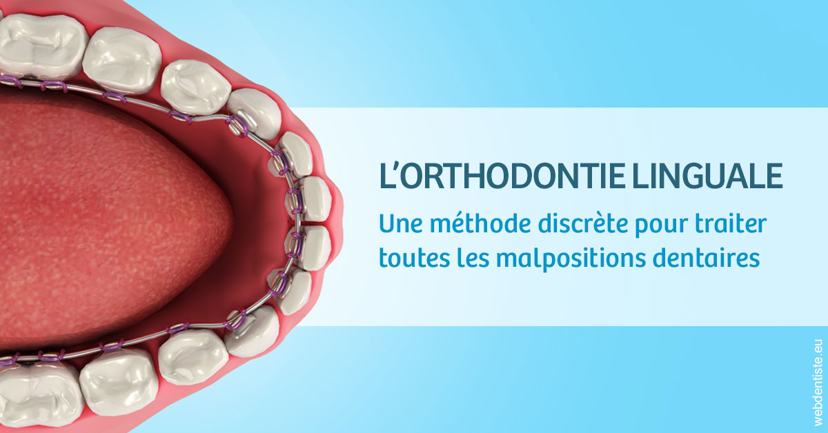 https://www.centre-dentaire-asnieres-les-gresillons.fr/L'orthodontie linguale 1