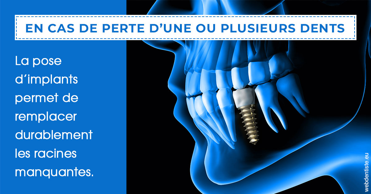 https://www.centre-dentaire-asnieres-les-gresillons.fr/2024 T1 - Implants 01