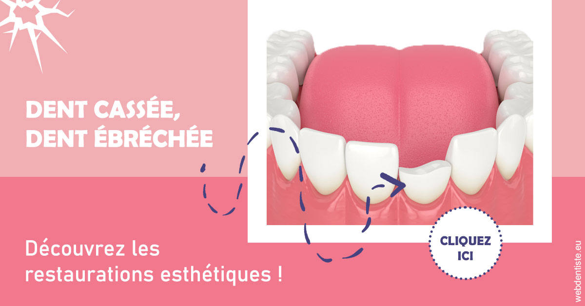https://www.centre-dentaire-asnieres-les-gresillons.fr/Dent cassée ébréchée 1